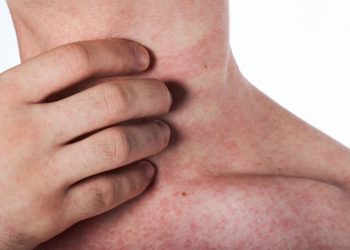 בקלינקה של זריף חולים וסובלים מצטופפים כמעט עד אפס מקום, ביניהם גם פרופסורים, רופאים, פיזיקאים